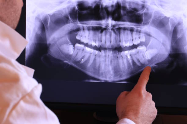 Best Cracked Tooth Emergency Dentist  in Safety Harbor, FL