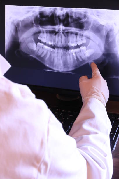 Teeth Whitening in FL