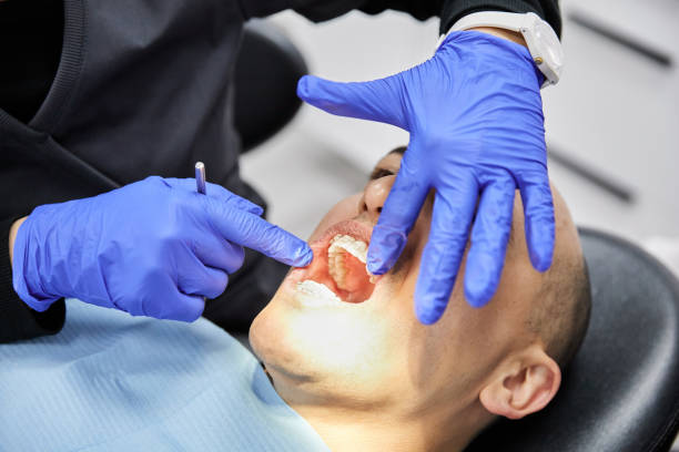 Best Knocked-Out Tooth Emergency  in Safety Harbor, FL